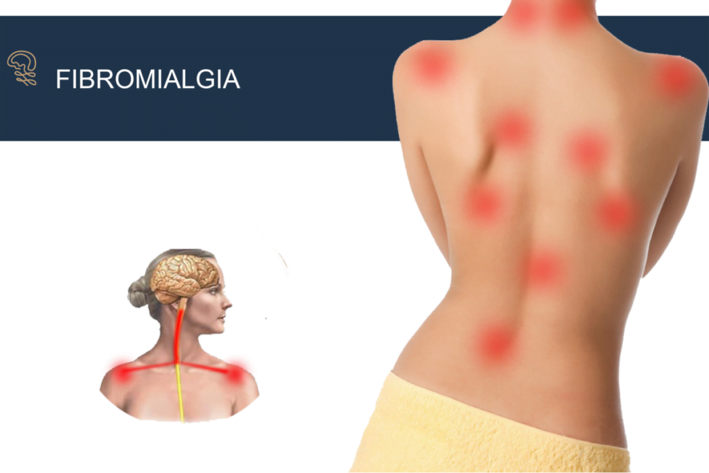 Fibromialgia-Dor-1200x800-1-1024x683 Fibromialgia. O que é?